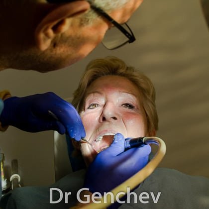 Dr Genchev placing a basal dental implant