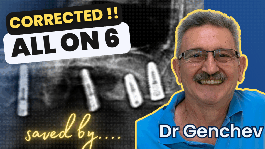 video thumbnail for a dental restoration with basal implants