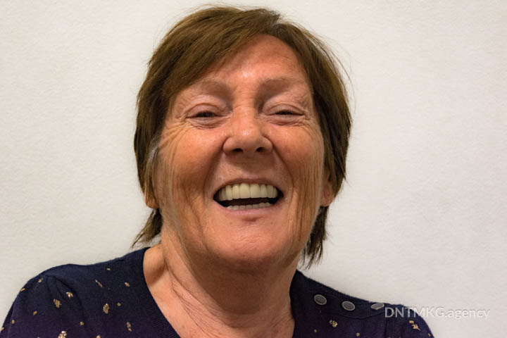 laughing patient after basal dental implantation procedure