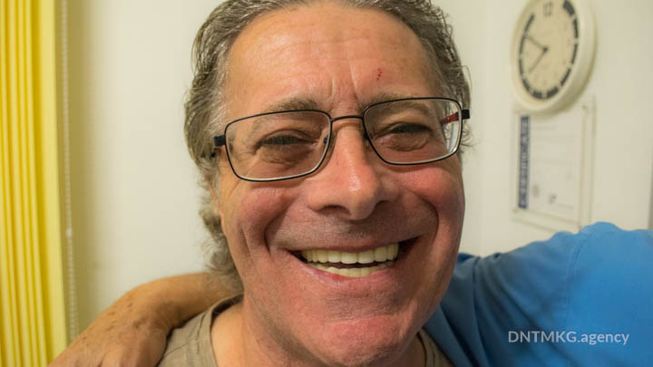 smoker patient smiling after basal dental implants