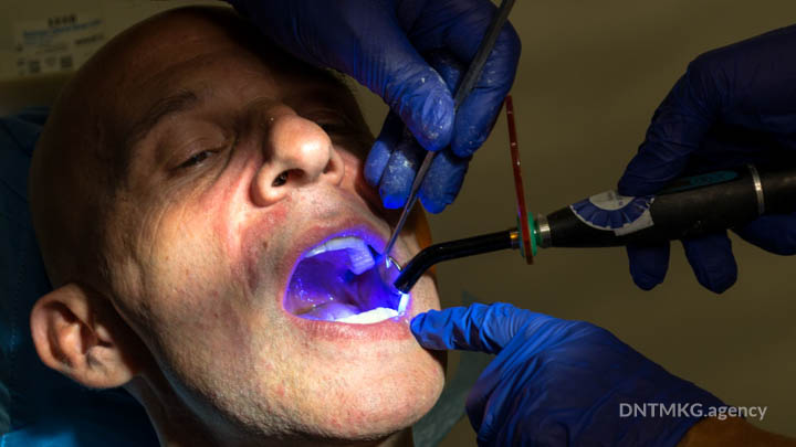Dr George fixes a basal dental implant