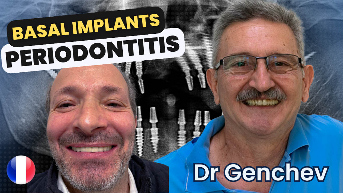 Basal Implants for Gum Disease